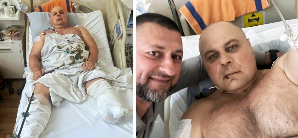 “After demobilization, I will definitely return to work in the forest,” says severely wounded soldier-forester Volodymyr Dominikin